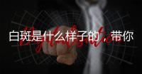 白斑是什么樣子的，帶你認識各種類型的白斑