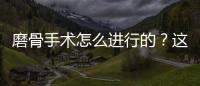 磨骨手術怎么進行的？這5點注意事項需要牢記~