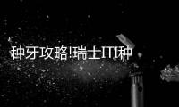 種牙攻略!瑞士ITI種植牙的價格直降2021,分三種檔次且壽命長