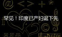 罕見！印度已產婦誕下先天畸形連體嬰：一個身體有三個頭