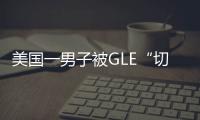 美國(guó)一男子被GLE“切斷”拇指 已起訴奔馳