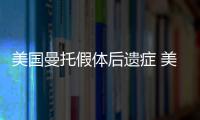 美國(guó)曼托假體后遺癥 美國(guó)曼托隆胸有什么后遺癥嗎