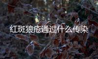 紅斑狼瘡通過什么傳染