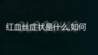紅血絲癥狀是什么,如何有效緩解紅血絲問題