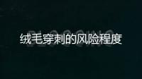 絨毛穿刺的風險程度