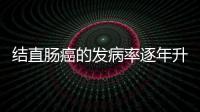 結(jié)直腸癌的發(fā)病率逐年升高 沿海大中城市尤為顯著