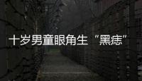 十歲男童眼角生“黑痣” 竟是被蜱蟲咬住眼角
