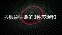 去眼袋失敗的3種表現和修復