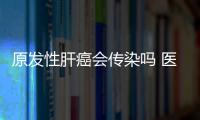 原發性肝癌會傳染嗎 醫生這樣說