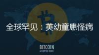 全球罕見：英幼童患怪病全身出紅色腫塊