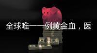 全球唯一一例黃金血，醫(yī)學(xué)家斷定活不過20歲(缺乏RH)