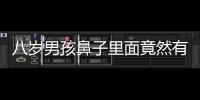 八歲男孩鼻子里面竟然有這個  醫生都驚呆