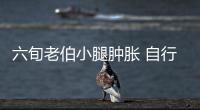 六旬老伯小腿腫脹 自行毛巾熱敷沒想到差點(diǎn)喪命