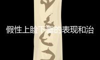 假性上瞼下垂的表現(xiàn)和治療