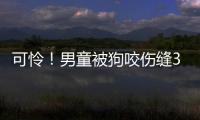 可憐！男童被狗咬傷縫30多針
