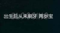 出生后從未刷牙 兩歲寶寶門牙變黑