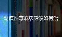 劃痕性蕁麻疹應(yīng)該如何治療