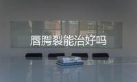 唇腭裂能治好嗎