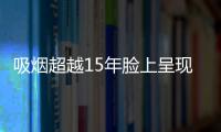 吸煙超越15年臉上呈現(xiàn)這種感覺真要當(dāng)心肺癌已上門