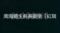 周海媚生前長(zhǎng)期受「紅斑性狼瘡」所苦，好發(fā)於20