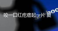 咬一口紅疙瘩起一片 夏季警惕蟲咬皮炎