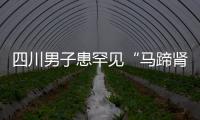 四川男子患罕見“馬蹄腎”  形如字母“U”