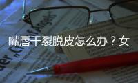 嘴唇干裂脫皮怎么辦？女性保養(yǎng)嘴唇只需做到這四點