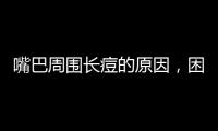 嘴巴周圍長痘的原因，困擾女生的痘痘問題四招解決