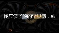 你應該了解的罕見病，威廉姆斯綜合癥