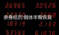 親身經歷:假體豐臀恢復期太難受了,術后異物感持續了一個月左右才消失