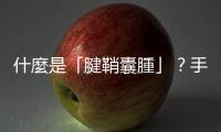 什麼是「腱鞘囊腫」？手腕背側腫了一顆「筋瘤」需要開刀嗎？
