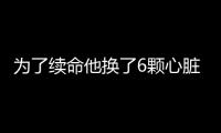 為了續命他換了6顆心臟于是他成為世界上最長壽首富