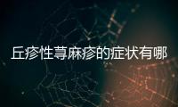 丘疹性蕁麻疹的癥狀有哪些？如何快速緩解丘疹性蕁麻疹？