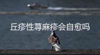 丘疹性蕁麻疹會(huì)自愈嗎