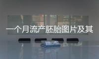 一個月流產(chǎn)胚胎圖片及其相關(guān)知識介紹