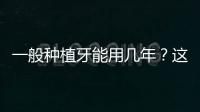 一般種植牙能用幾年？這些真相你必須要了解清楚