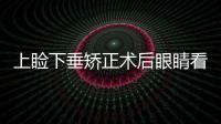 上瞼下垂矯正術后眼睛看起來自然嗎？