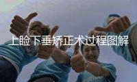 上瞼下垂矯正術(shù)過程圖解是什么？上瞼下垂有什么影響嗎？