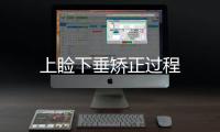 上瞼下垂矯正過程