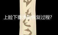 上瞼下垂術后恢復過程?上瞼下垂有什么影響?