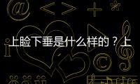 上瞼下垂是什么樣的？上瞼下垂能自己變好嗎？