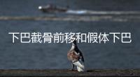 下巴截骨前移和假體下巴哪個好?看優(yōu)勢就知道怎么選