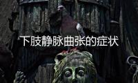 下肢靜脈曲張的癥狀