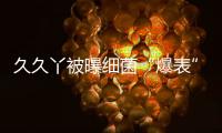 久久丫被曝細(xì)菌“爆表”