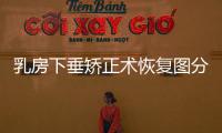 乳房下垂矯正術恢復圖分享，讓胸部恢復到自然挺拔~