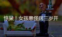 驚呆！女孩患怪病三歲開始吃頭發(fā)
