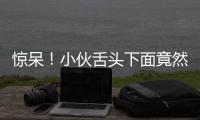 驚呆！小伙舌頭下面竟然長了結石