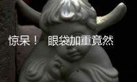 驚呆！  眼袋加重竟然是癌癥預(yù)兆