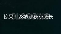 驚呆！28歲小伙小腸長400多顆息肉