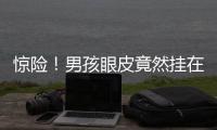 驚險！男孩眼皮竟然掛在掛鉤上
